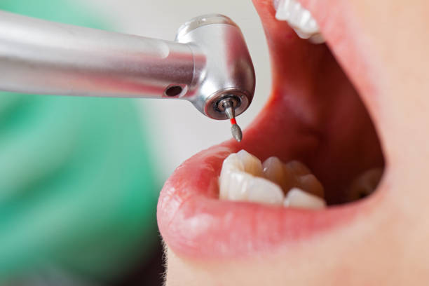 Best Emergency Treatment for Dental Infections or Abscesses in Chaparral, NM